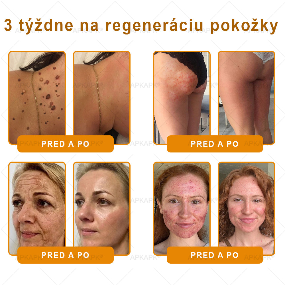 🎄APKAPK® Včelí jed regeneračný krém na pokožku 🔥 Vyvinuté na Slovensku, vyrobené a dodávané zo Slovenska
