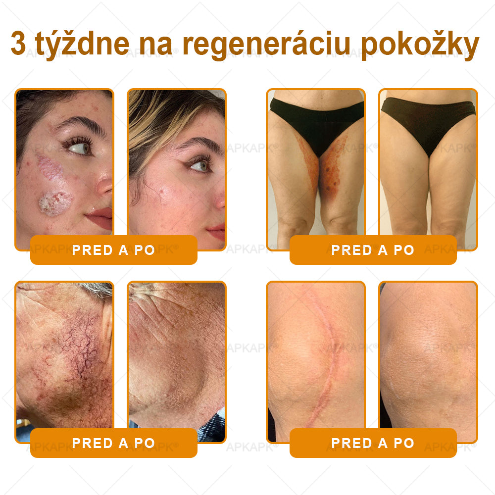 🎄APKAPK® Včelí jed regeneračný krém na pokožku 🔥 Vyvinuté na Slovensku, vyrobené a dodávané zo Slovenska