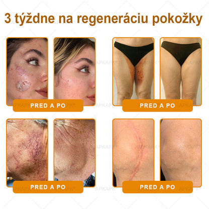 🎄APKAPK® Včelí jed regeneračný krém na pokožku 🔥 Vyvinuté na Slovensku, vyrobené a dodávané zo Slovenska