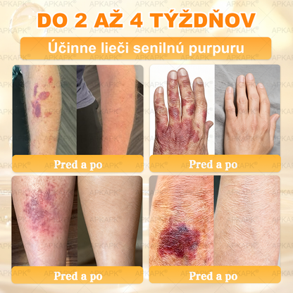🎄APKAPK® Včelí jed regeneračný krém na pokožku 🔥 Vyvinuté na Slovensku, vyrobené a dodávané zo Slovenska