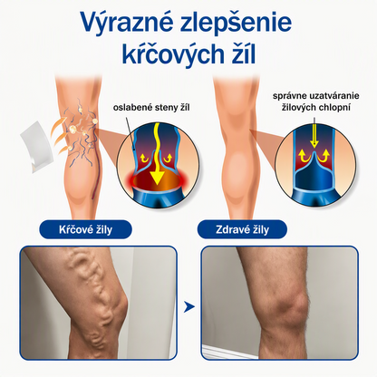 🎉 IBA DNES – VÝNIMOČNÁ PONUKA! 🔥 Pridajte ďalšie balenie náplastí na starostlivosť o nohy FFBSI® a získajte AŽ 50 % ZĽAVU! ✨ ⭐ Viac náplastí – pohodlnejšie pokračovať v pravidelnej starostlivosti o nohy! 💚 ⏰ Nepremeškajte – ponuka platí obmedzený čas!