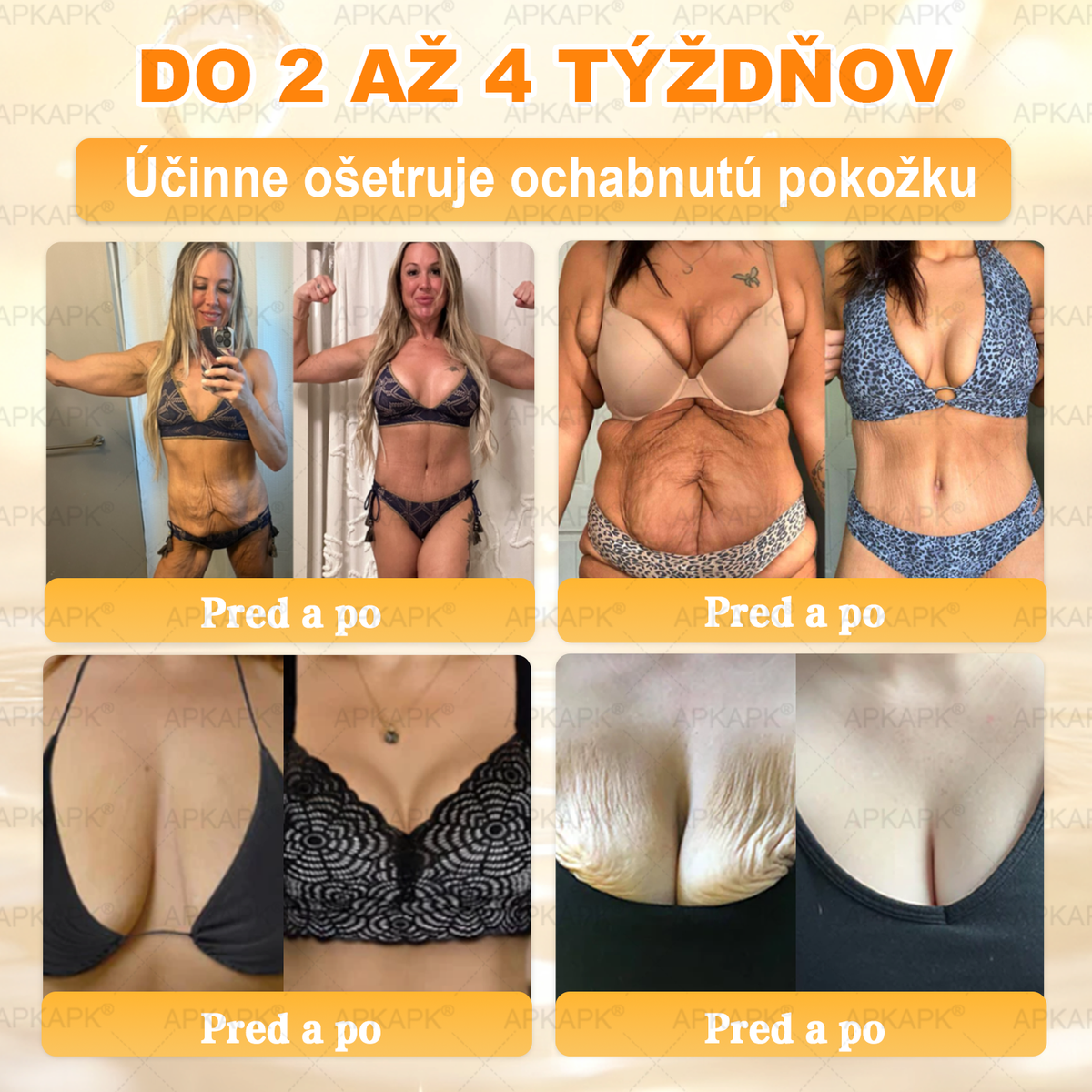 🎄APKAPK® Včelí jed regeneračný krém na pokožku 🔥 Vyvinuté na Slovensku, vyrobené a dodávané zo Slovenska