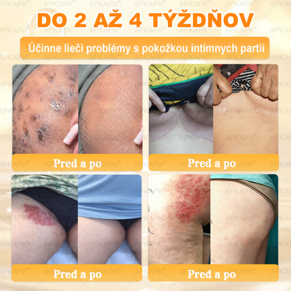 🎄APKAPK® Včelí jed regeneračný krém na pokožku 🔥 Vyvinuté na Slovensku, vyrobené a dodávané zo Slovenska