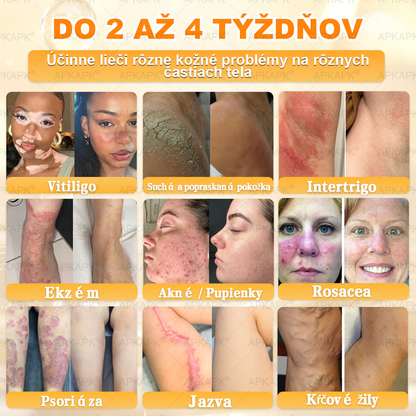 🎄APKAPK® Včelí jed regeneračný krém na pokožku 🔥 Vyvinuté na Slovensku, vyrobené a dodávané zo Slovenska