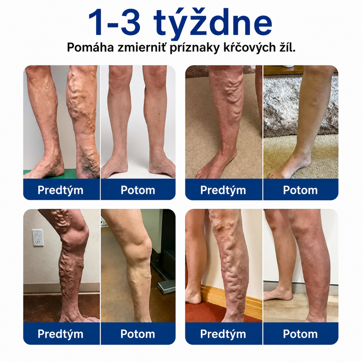 🎉 IBA DNES – VÝNIMOČNÁ PONUKA! 🔥 Pridajte ďalšie balenie náplastí na starostlivosť o nohy FFBSI® a získajte AŽ 50 % ZĽAVU! ✨ ⭐ Viac náplastí – pohodlnejšie pokračovať v pravidelnej starostlivosti o nohy! 💚 ⏰ Nepremeškajte – ponuka platí obmedzený čas!