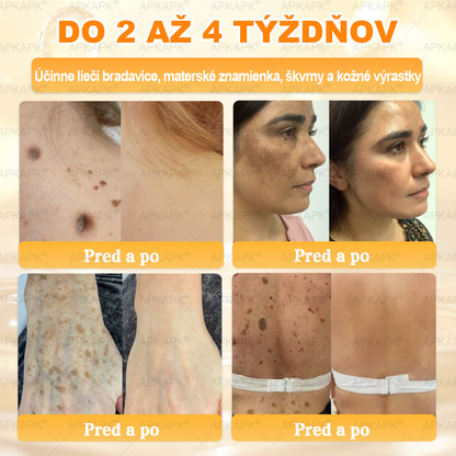 🎄APKAPK® Včelí jed regeneračný krém na pokožku 🔥 Vyvinuté na Slovensku, vyrobené a dodávané zo Slovenska