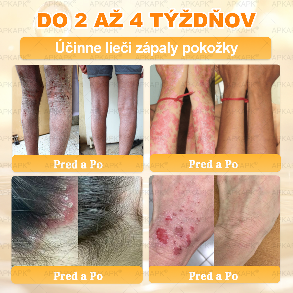 🎄APKAPK® Včelí jed regeneračný krém na pokožku 🔥 Vyvinuté na Slovensku, vyrobené a dodávané zo Slovenska